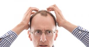 Konzept Depression oder Burnout: Mann isoliert mit Haarausfall