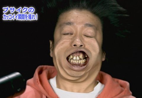 バナナマン日村勇紀の歯並び&歯列矯正まとめ!矯正を決意した理由&病院&その後の変化も徹底紹介